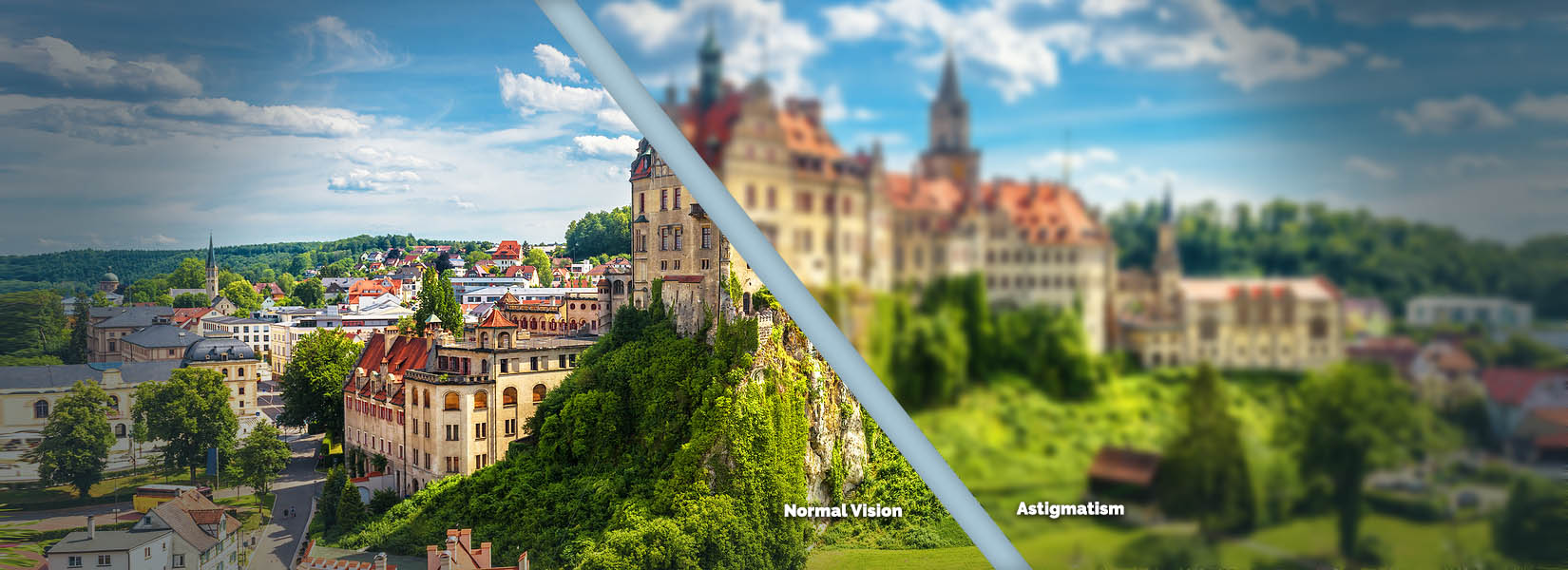 Astigmatism Treatment in Central West End